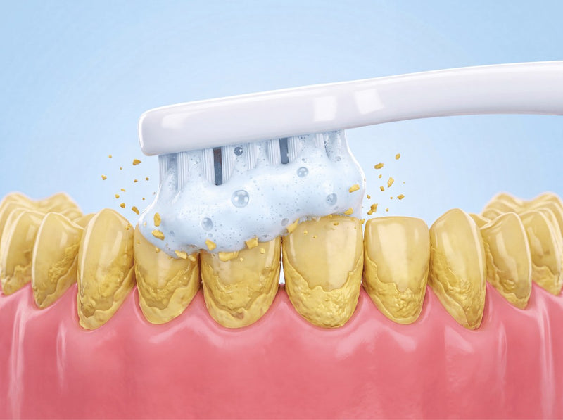 That Dentist-Clean Feeling